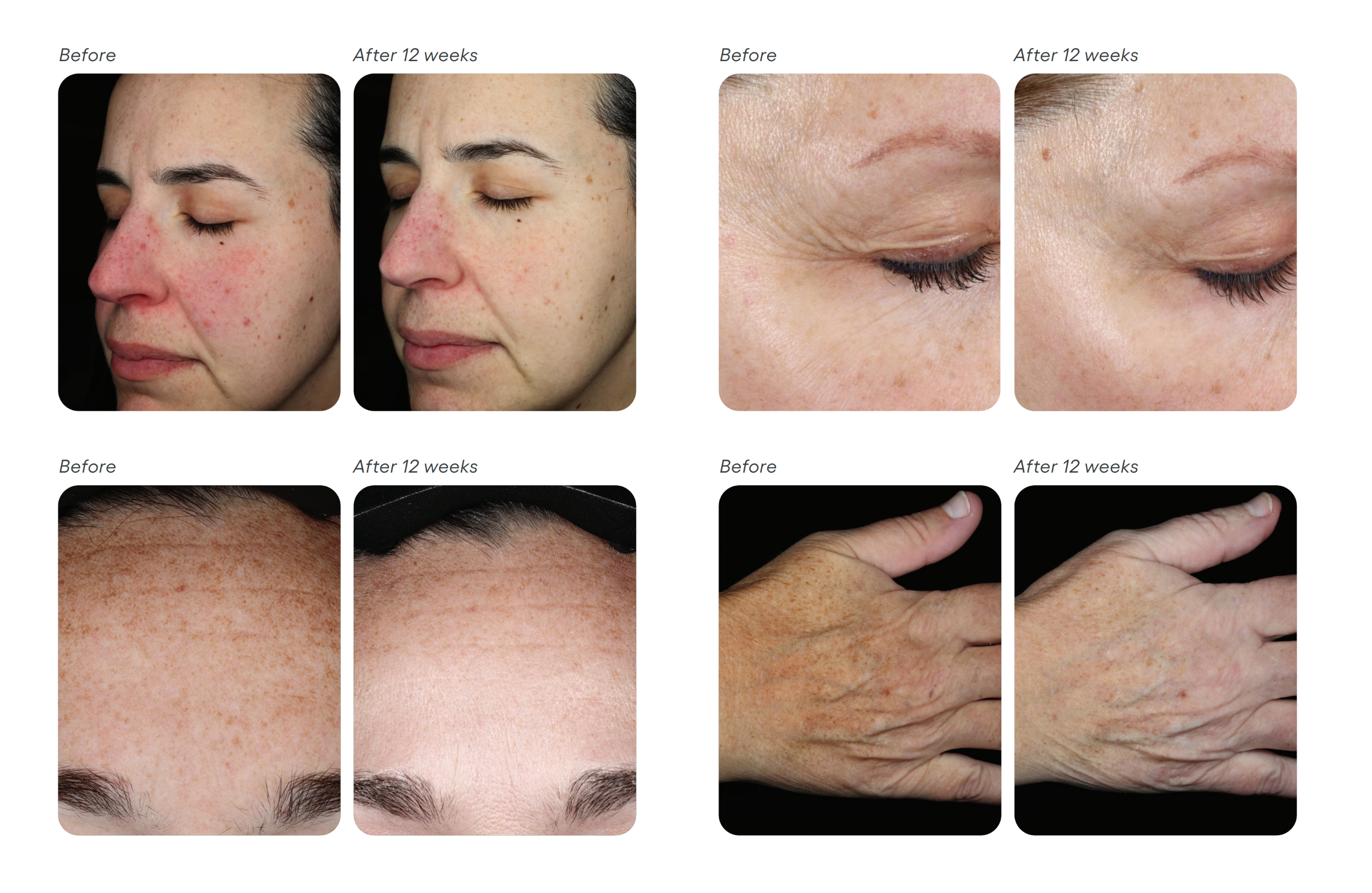 Before and after comparison of skin treatment on various body parts.
