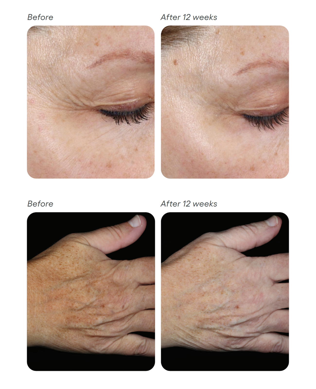 Before and after comparison of skin treatment on various body parts.