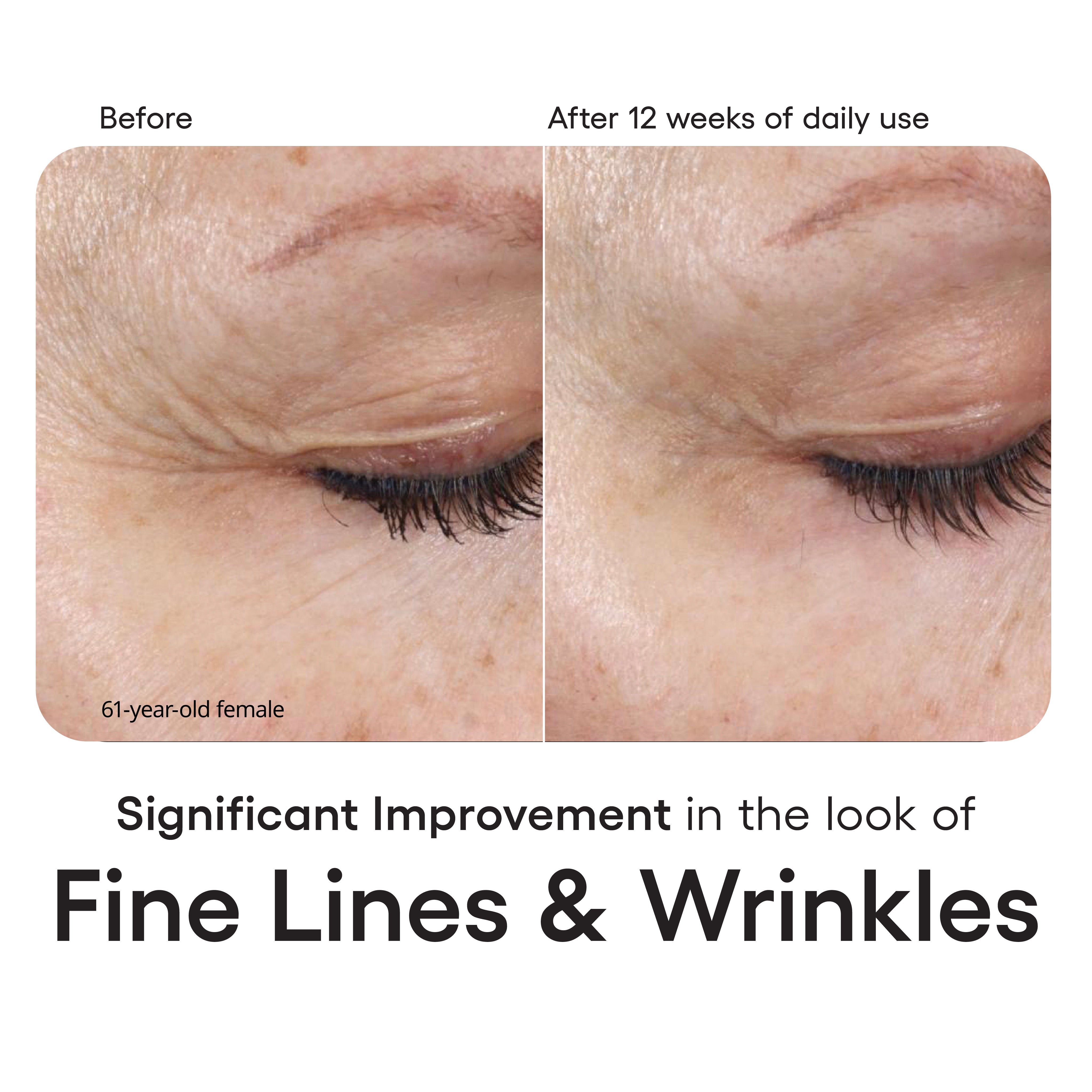 INTENSE Serum Refill